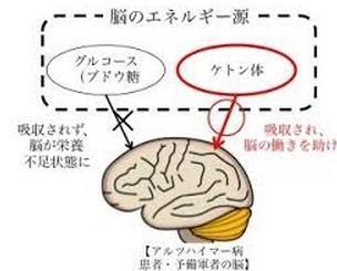 ココナッツで認知症予防その２ ココナッツでヘルシー ビュティー